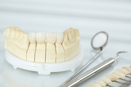 Günstiger Zahnersatz von SAVEDENTAL – durch Qualifikation und Kommunikation